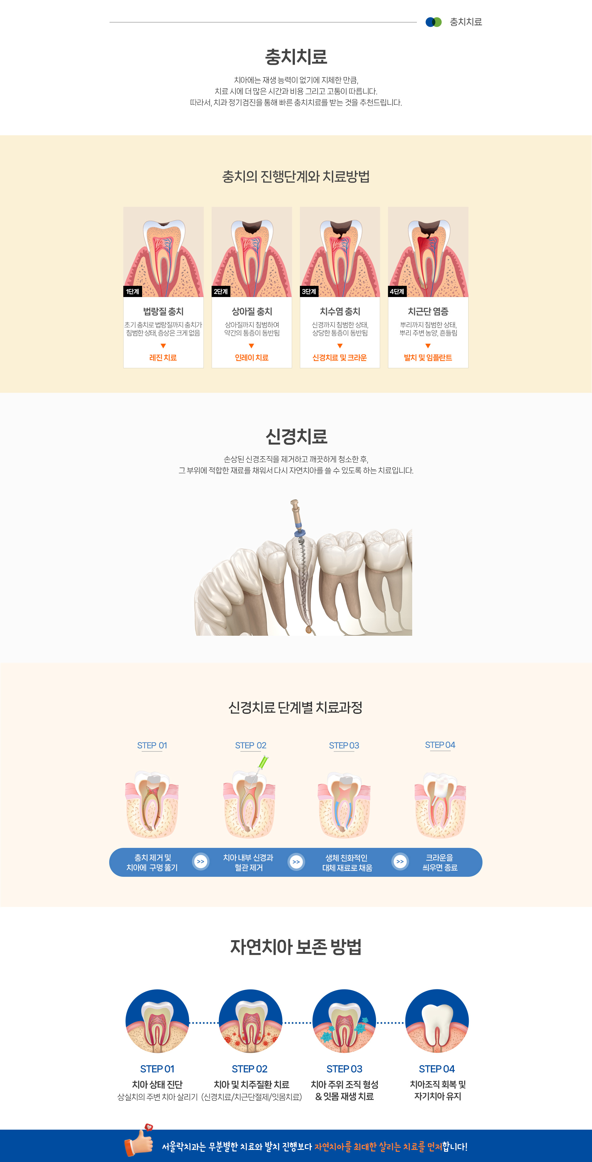 충치치료